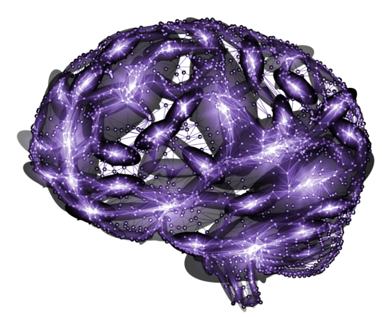 brain diagram with purple shading